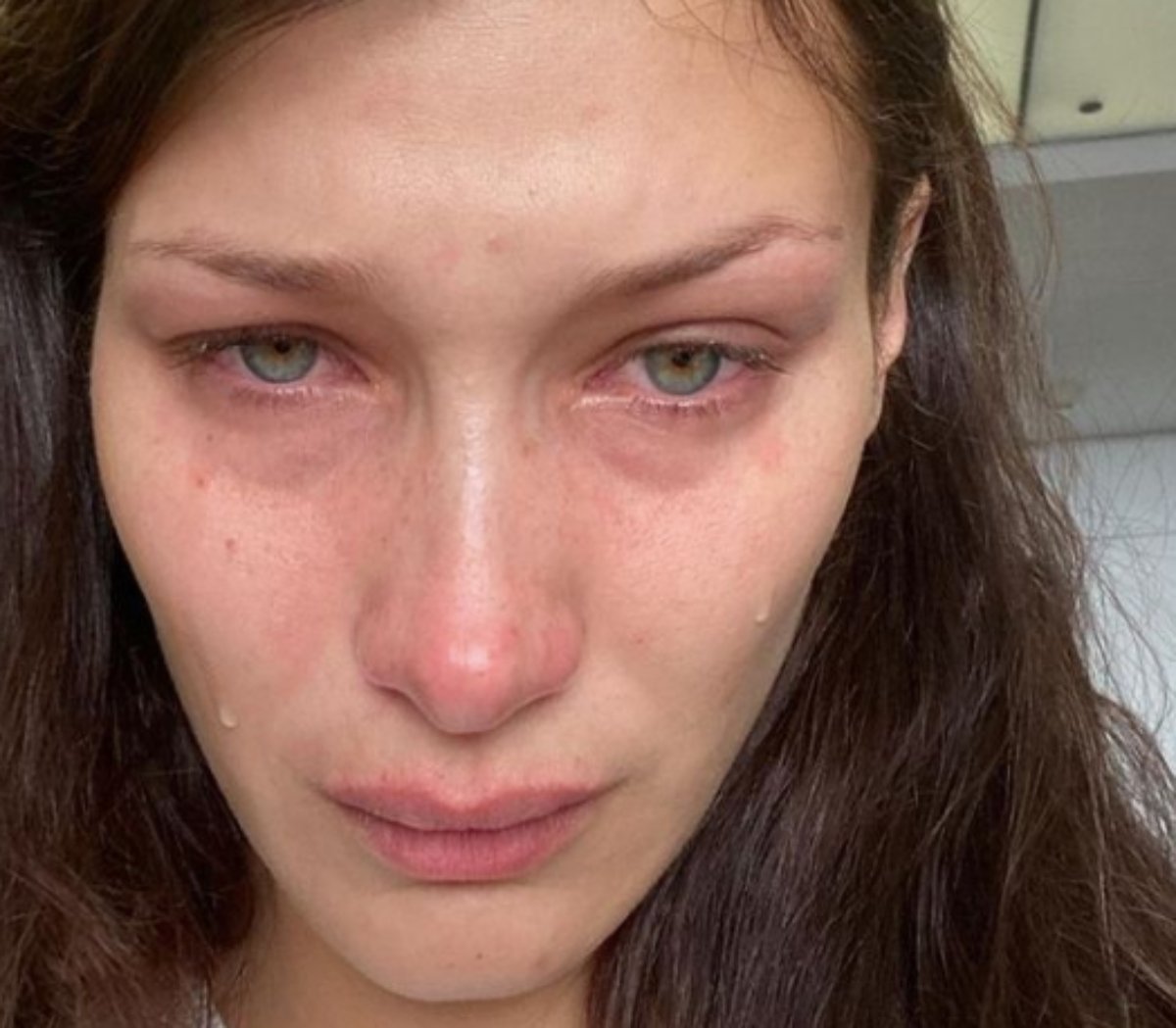 Bella Hadid: Η κατάθλιψη από τα social media και το pep talk προς τους ακόλουθους της