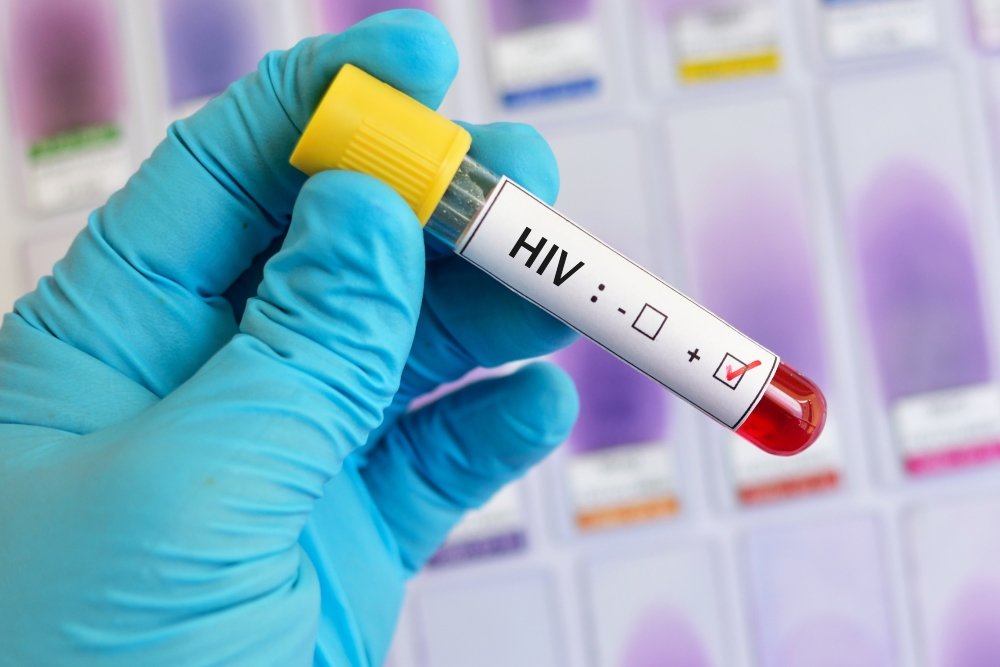 Ασθενής αυτο-θεραπεύτηκε από τον HIV χωρίς φάρμακα για 2η φορά στα χρονικά