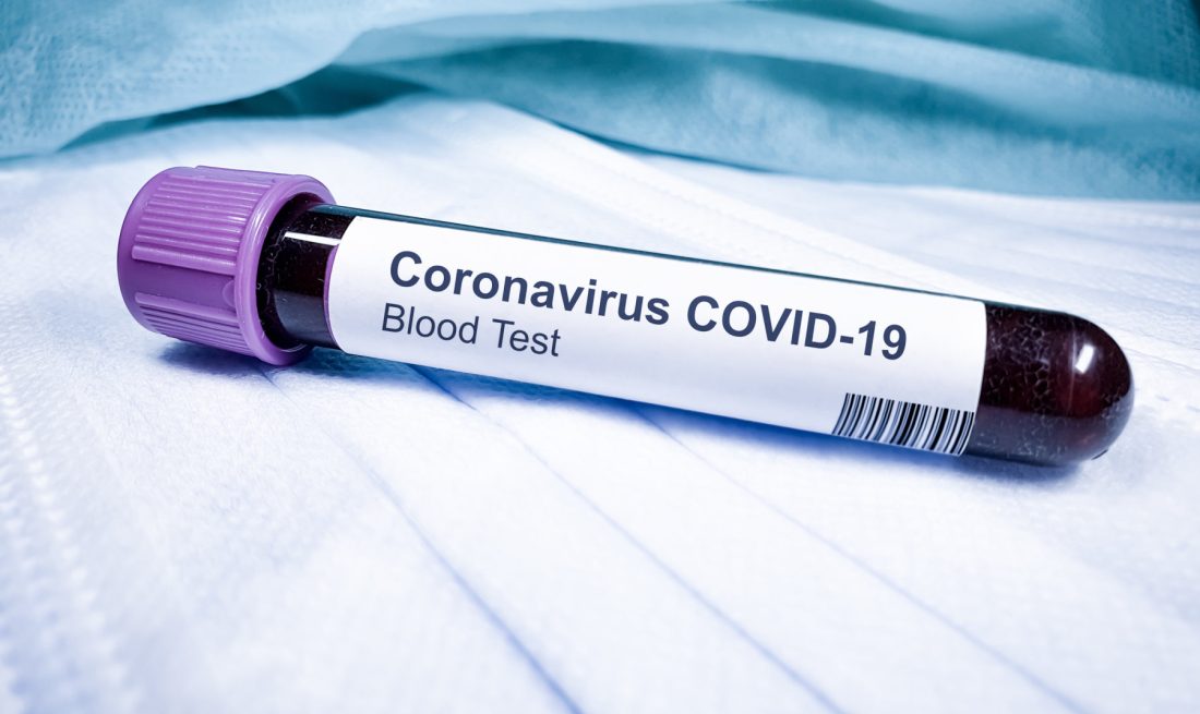 Το φάρμακο κατά του Covid που προκαλεί τις μεταλλάξεις – Κάνει ανθεκτικό τον ιό