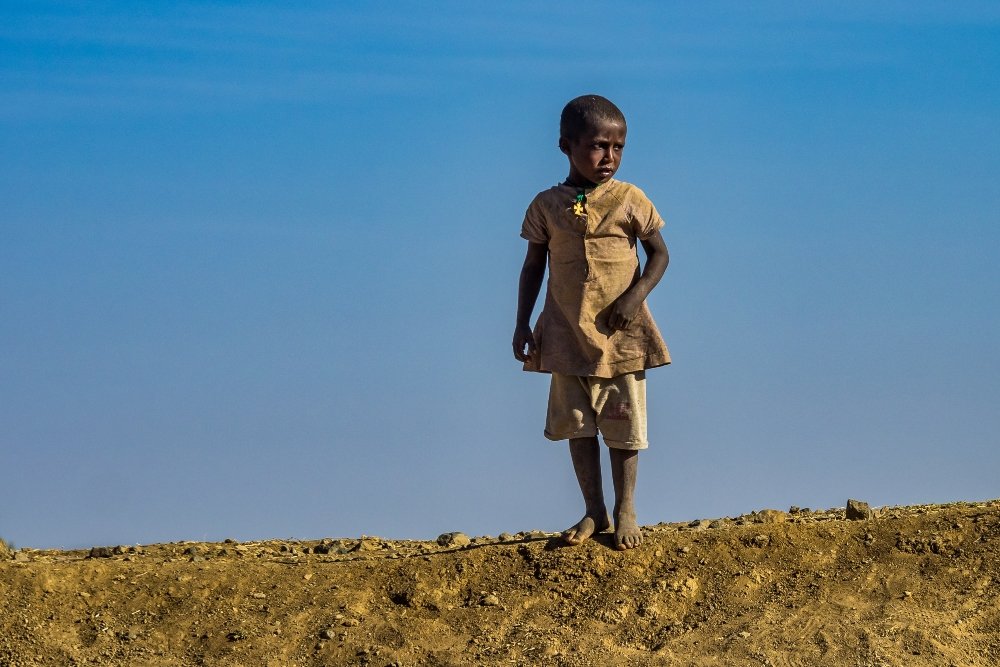 Αιθιοπία: Το αποτύπωμα του εμφυλίου – Αποστεωμένα κι υποσιτισμένα παιδιά στην κοιλάδα Τιγκράι