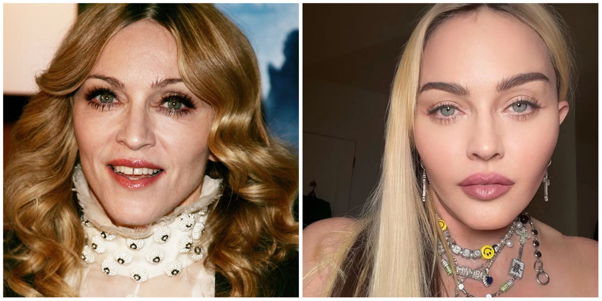 Madonna: Δείχνει το αληθινό της πρόσωπο χωρίς φίλτρα και μακιγιάζ- «Θεέ μου, γιατί το έκανες;», λέει στο βίντεο