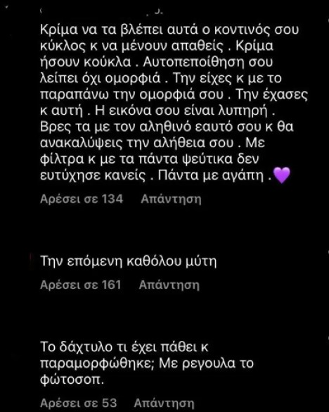 Ιωάννα Μπέλλα: Αγνώριστη η πρώην παίκτρια του GNTM - «Ούτε η Καρντάσιαν τόση πλαστικούρα» Ιωάννα Μπέλλα