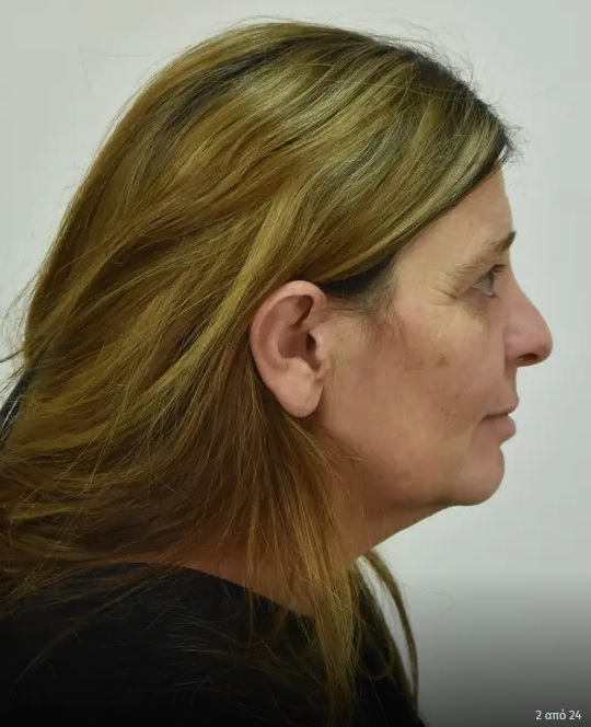 Αυτή είναι η... Μπολονέζα «νόνα» της συμμορίας που έγδυνε μαγαζιά Μπολονέζα «νόνα»