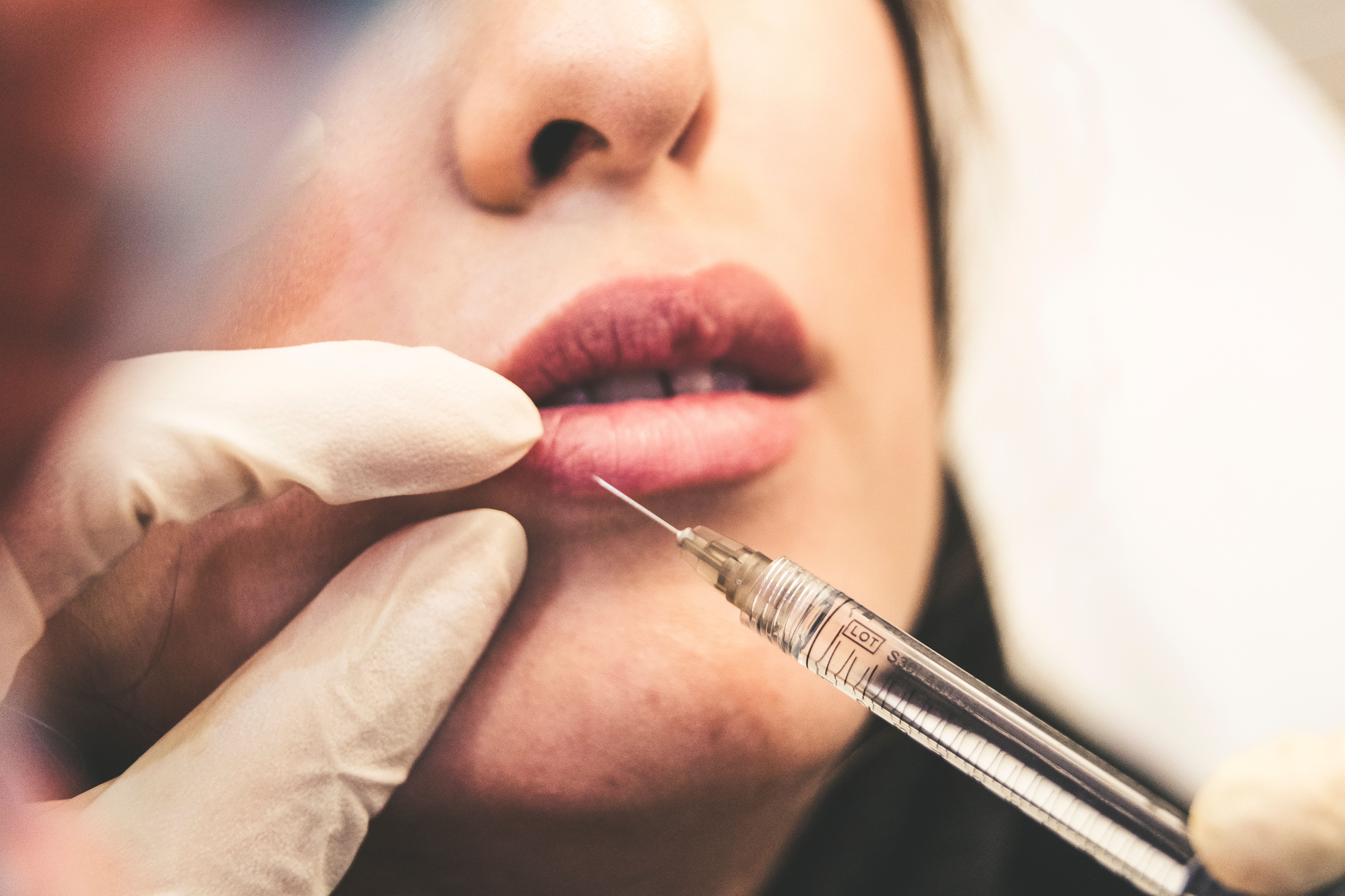 Κύκλωμα «μαϊμού» botox: «Μου έβαλαν μαρμαρόσκονη αντί για τοξίνη»