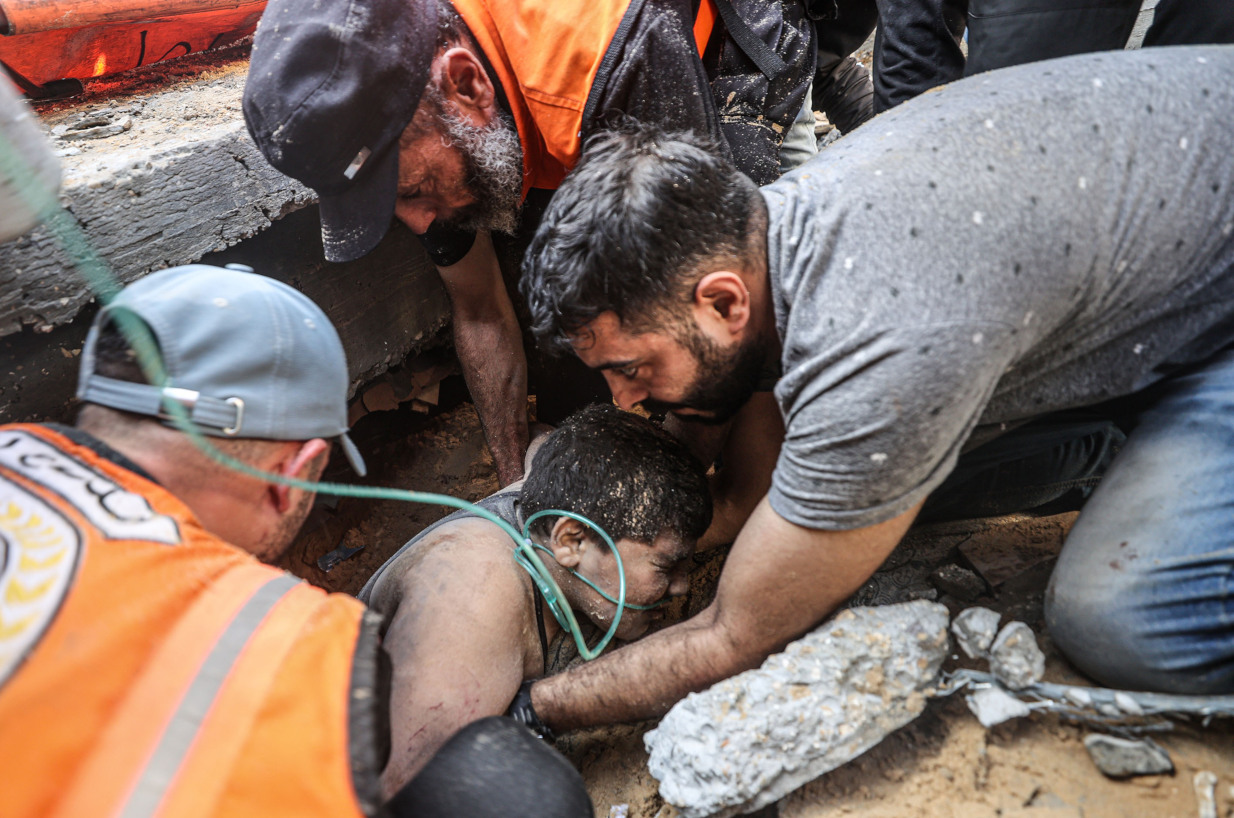 Γάζα: Απελπιστική η κατάσταση στα νοσοκομεία – Χειρουργούνται ασθενείς στο πάτωμα και χωρίς αναισθησία